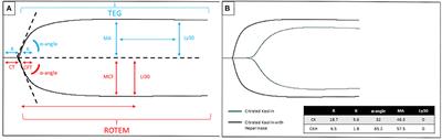 Viscoelastic Testing in Pediatric Mechanical Circulatory Support